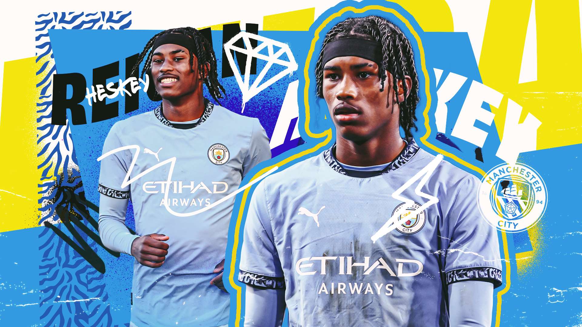 冠军比其他 冠军比其他